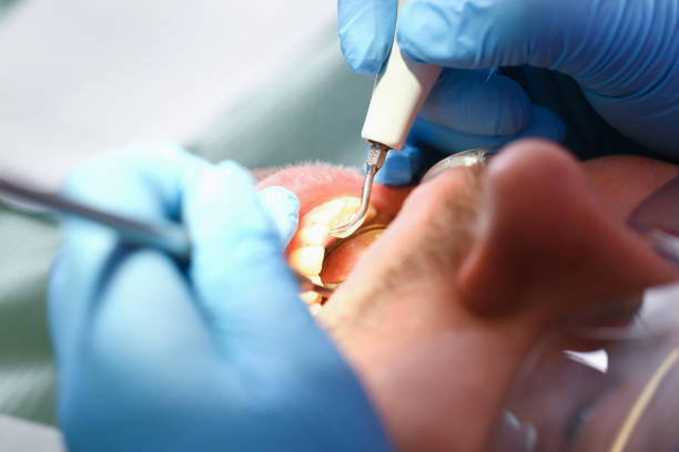 Best Emergency Dental Care for Abscessed Tooth in Whiteville, TN
